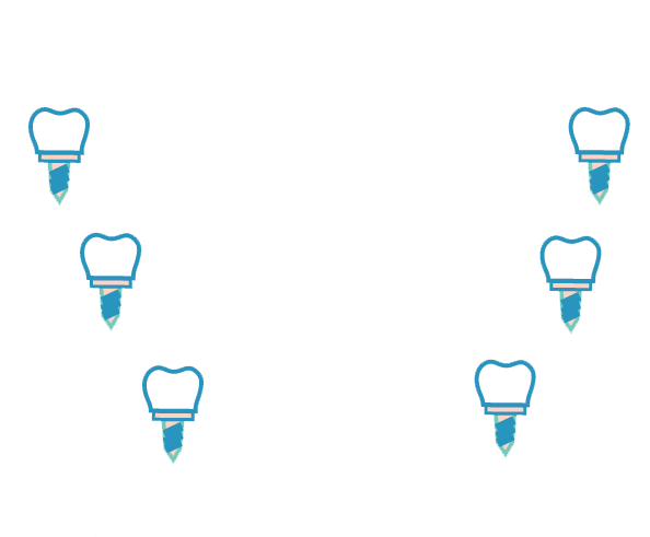 All-On-6 -dental-Implant-Treatment